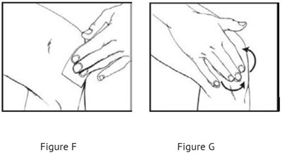 F (Fig F  D)